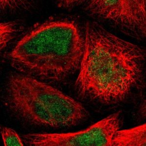Anti-TTC14 antibody produced in rabbit HPA009295-100UL