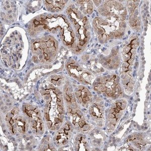 Anti-TTC17 antibody produced in rabbit 