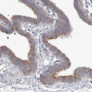 Anti-TTC21B antibody produced in rabbit 