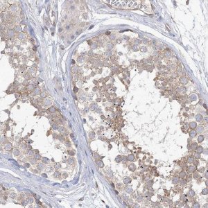 Anti-TTC21B antibody produced in rabbit 