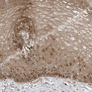 Anti-TTC22 antibody produced in rabbit 