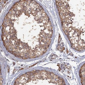 Anti-TTC23 antibody produced in rabbit 