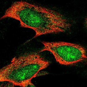Anti-TTC3 antibody produced in rabbit 