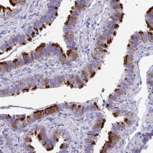 Anti-TTC30A antibody produced in rabbit 