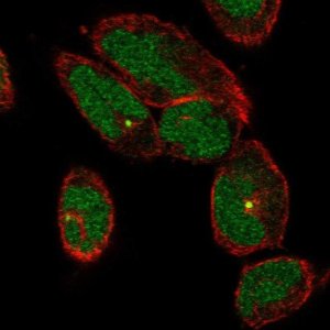Anti-TTC30A antibody produced in rabbit 