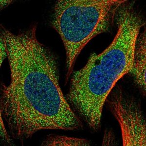 Anti-TTC31 antibody produced in rabbit 