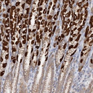 Anti-TTC32 antibody produced in rabbit 