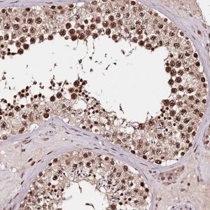 Anti-TTC33 antibody produced in rabbit 