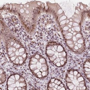 Anti-TTC34 antibody produced in rabbit 
