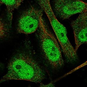 Anti-TTC37 antibody produced in rabbit 