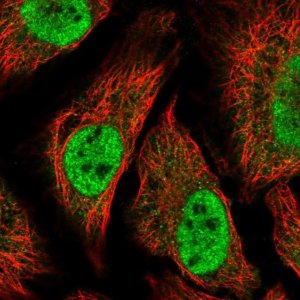 Anti-TTC39C antibody produced in rabbit 