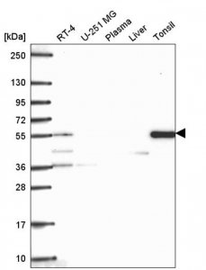 Anti-TTC39C antibody produced in rabbit 