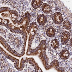 Anti-TTC4 antibody produced in rabbit 