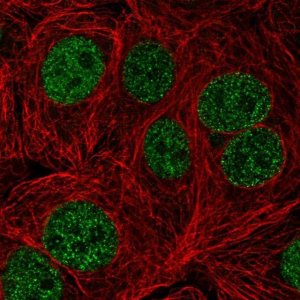 Anti-TTC5 antibody produced in rabbit 
