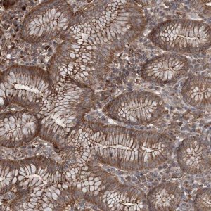 Anti-TTC7A antibody produced in rabbit 