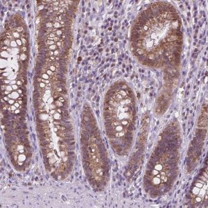 Anti-TTC9B antibody produced in rabbit 