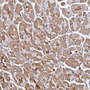 Anti-TTC9C antibody produced in rabbit 