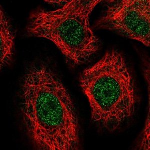 Anti-TTC9C antibody produced in rabbit 