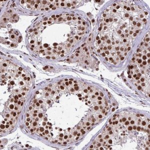 Anti-TTF1 antibody produced in rabbit 