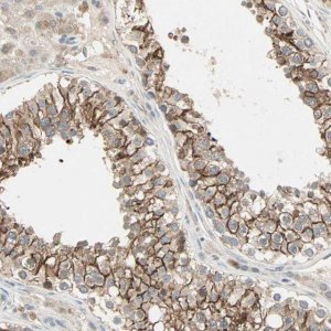 Anti-TTF2 antibody produced in rabbit HPA005776-100UL