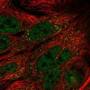 Anti-TTI1 antibody produced in rabbit 