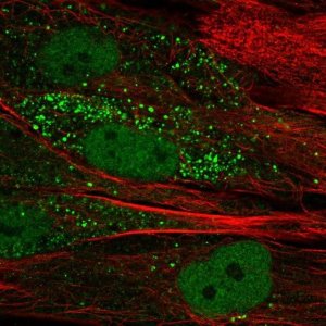 Anti-TTL antibody produced in rabbit 