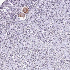 Anti-TTLL3 antibody produced in rabbit 