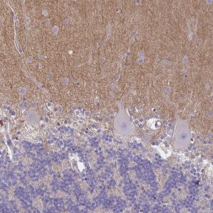 Anti-TTYH1 antibody produced in rabbit HPA050655-100UL