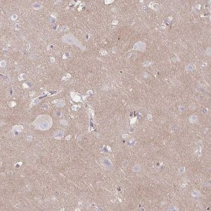 Anti-TTYH1 antibody produced in rabbit HPA050655-100UL