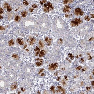 Anti-TTYH3 antibody produced in rabbit 