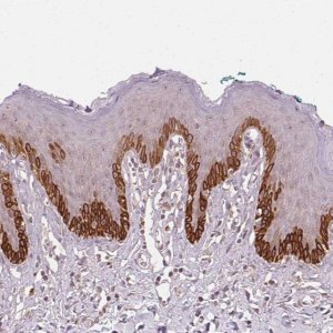 Anti-TUB antibody produced in rabbit 