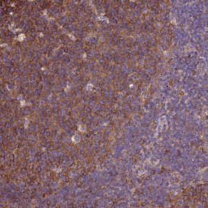 Anti-TUBB antibody produced in rabbit HPA046280-100UL