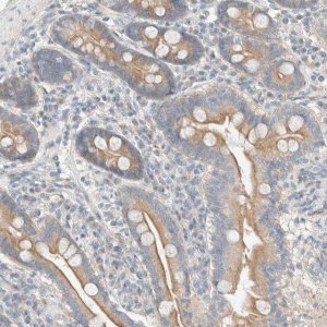 Anti-TUBD1 antibody produced in rabbit 