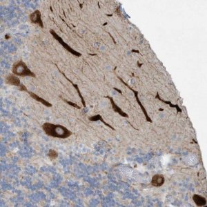 Anti-TUBE1 antibody produced in rabbit HPA032073-100UL