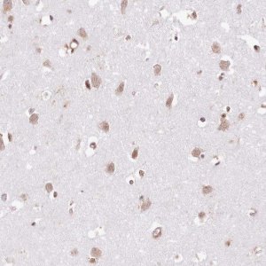 Anti-TUBGCP2 antibody produced in rabbit 
