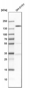 Anti-TULP4 antibody produced in rabbit 