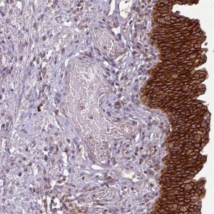 Anti-TUSC3 antibody produced in rabbit 
