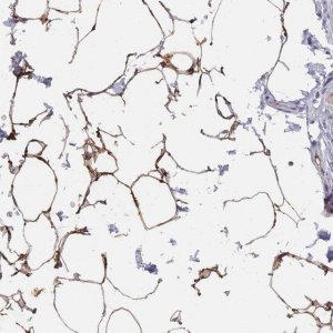 Anti-TUSC5 antibody produced in rabbit 