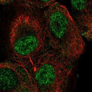 Anti-TUT1 antibody produced in rabbit 