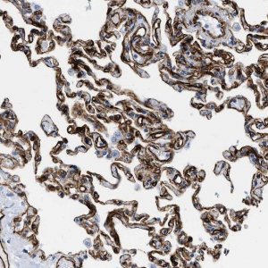 Anti-TVP23B antibody produced in rabbit 