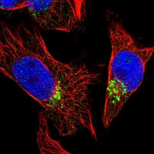 Anti-TVP23B antibody produced in rabbit 