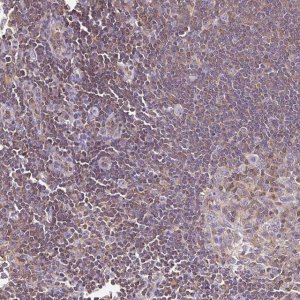 Anti-TWF2 antibody produced in rabbit HPA053874-100UL