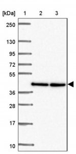 Anti-TWF2 antibody produced in rabbit HPA053874-100UL