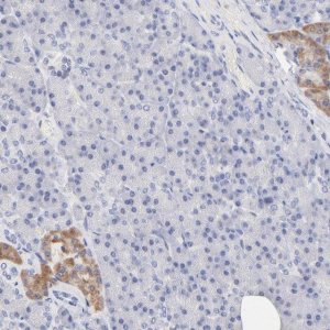 ANTI-TWNK antibody produced in rabbit 