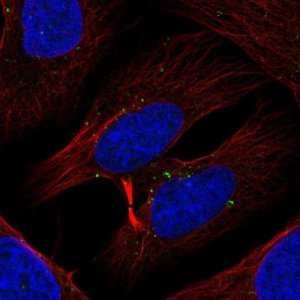 Anti-TXK antibody produced in rabbit 