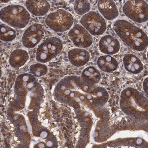 Anti-TXNDC16 antibody produced in rabbit 