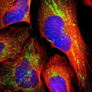 Anti-TXNDC16 antibody produced in rabbit 