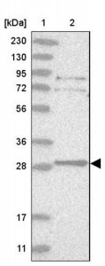 Anti-TXNDC9 antibody produced in rabbit 