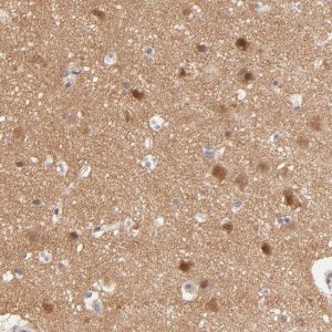 Anti-TXNL1 antibody produced in rabbit HPA002828-100UL