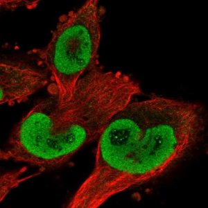 Anti-TXNRD1 antibody produced in rabbit 